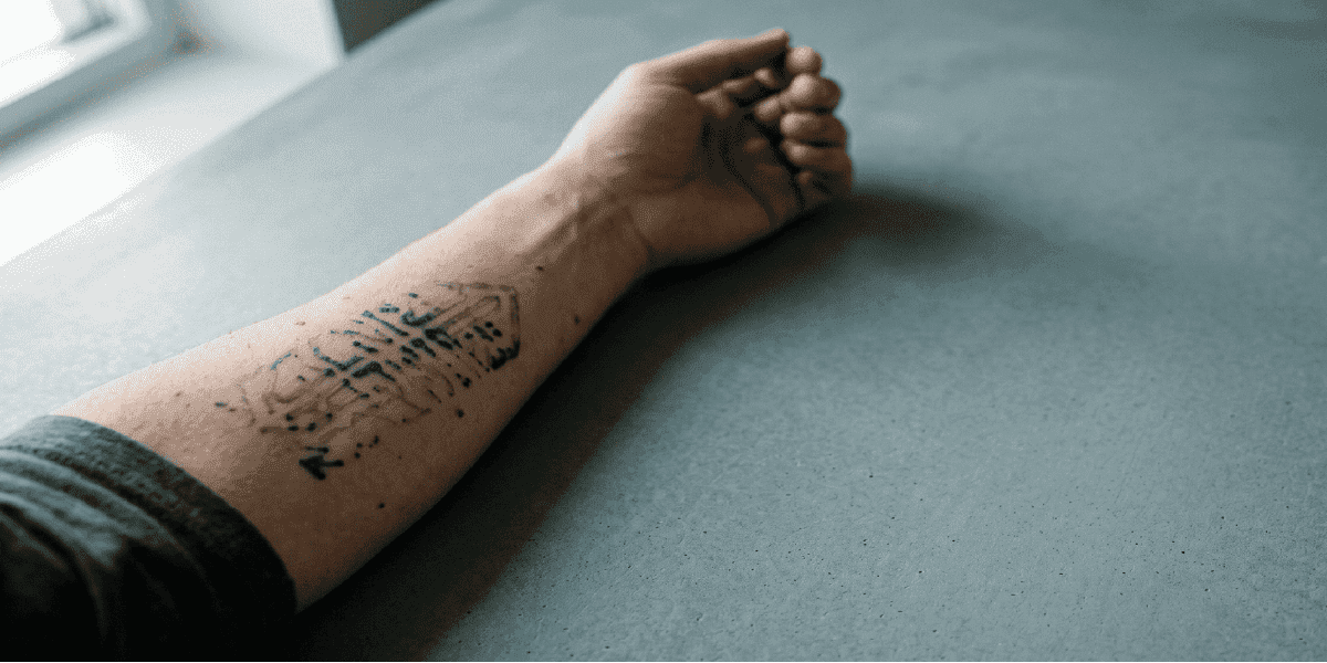 How Many Sessions Does It Take to Remove a Tattoo (2026)